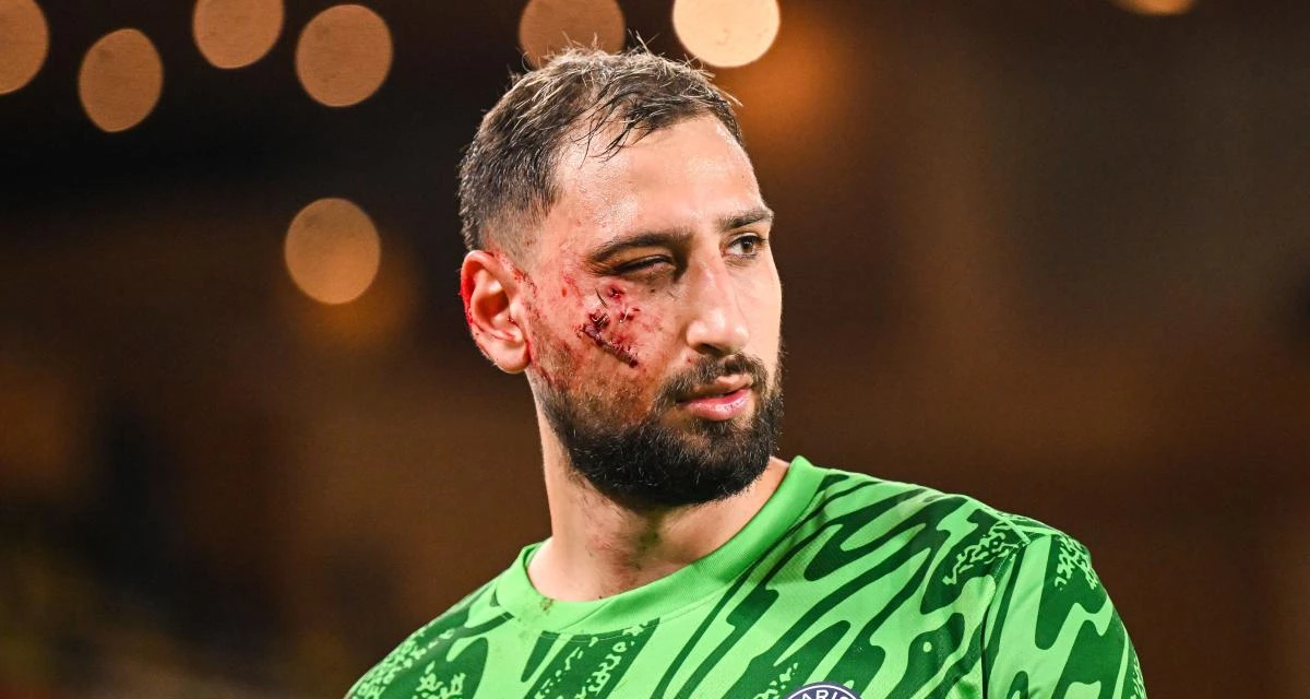 Photo de couverture de l'article Donnarumma blessé au visage : le PSG dévoile le premier diagnostic