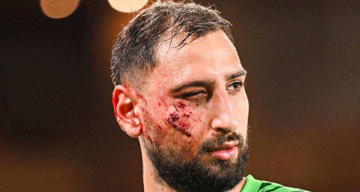 Photo de couverture de l'article Donnarumma blessé : Le gardien du PSG marqué par un choc violent lors du match contre Monaco